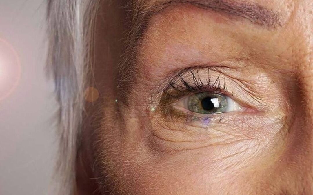 Facts About Cataracts